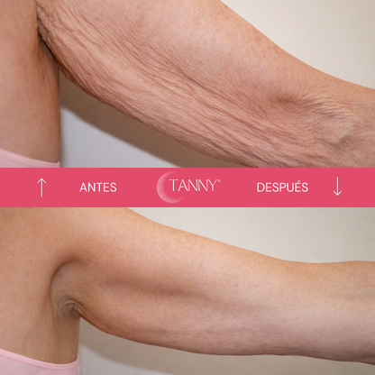 Tratamiento Para Celulitis Reafirmante Corporal