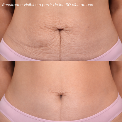 Tratamiento Para Celulitis Reafirmante Corporal